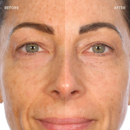 Comprar Toty Transforma AHA Serum