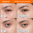 Comprar Shiseido Brightamin Brightening Eye Serum Stick